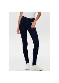 Only , Skinny-fit-Jeans »ONLROYAL HIGH SKINNY JEANS 101« , blau , Skinny-fit-Jeans formt und betont Beine und Hüfte für eine schlanke Silhouette